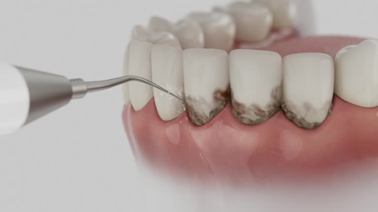 Reliable Dental contractor in Ladera Heights, CA by Smile Center Dentistry